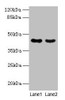Western blot<br />
 All lanes: MAS1L antibody at 2µg/ml<br />
 Lane 1: Colo320 whole cell lysate<br />
 Lane 2: Hela whole cell lysate<br />
 Secondary<br />
 Goat polyclonal to rabbit IgG at 1/10000 dilution<br />
 Predicted band size: 43 kDa<br />
 Observed band size: 43 kDa<br />
