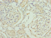 Immunohistochemistry of paraffin-embedded human kidney tissue using CSB-PA013517LA01HU at dilution of 1:100