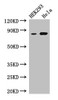 Western Blot<br />
 Positive WB detected in: HEK293 whole cell lysate, Hela whole cell lysate<br />
 All lanes: MELTF antibody at 3µg/ml<br />
 Secondary<br />
 Goat polyclonal to rabbit IgG at 1/50000 dilution<br />
 Predicted band size: 81, 33 kDa<br />
 Observed band size: 81 kDa<br />