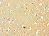 Immunohistochemistry of paraffin-embedded human brain tissue using CSB-PA013761LA01HU at dilution of 1:100