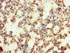 Immunohistochemistry of paraffin-embedded human lung tissue using CSB-PA013761LA01HU at dilution of 1:100