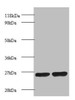 Western blot<br />
 All lanes: Proteasome subunit beta 1 antibody at 2µg/ml<br />
 Lane 1: EC109 whole cell lysate<br />
 Lane 2: 293T whole cell lysate<br />
 Secondary<br />
 Goat polyclonal to rabbit IgG at 1/15000 dilution<br />
 Predicted band size: 27 kDa<br />
 Observed band size: 27 kDa<br />