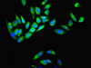 Immunofluorescent analysis of Hela cells using CSB-PA01405A0Rb at dilution of 1:100 and Alexa Fluor 488-congugated AffiniPure Goat Anti-Rabbit IgG (H+L)