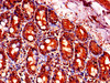 Immunohistochemistry of paraffin-embedded human small intestine tissue using CSB-PA01415A0Rb at dilution of 1:100