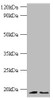 Western blot<br />
 All lanes: Histone H3.3 antibody at 2µg/ml<br />
 Lane 1: 293T whole cell lysate<br />
 Lane 2: EC109 whlole cell lysate<br />
 Secondary<br />
 Goat polyclonal to rabbit IgG at 1/1000 dilution<br />
 Predicted band size: 15 kDa<br />
 Observed band size: 15 kDa<br />
