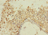 Immunohistochemistry of paraffin-embedded human testis tissue using CSB-PA014632LA01HU at dilution of 1:100