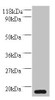 Western blot<br />
 All lanes: MRFAP1L1 antibody at 2µg/ml + HepG2 whole cell lysate<br />
 Secondary<br />
 Goat polyclonal to rabbit IgG at 1/10000 dilution<br />
 Predicted band size: 15 kDa<br />
 Observed band size: 15 kDa<br />