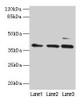 Western blot<br />
 All lanes: MRPL3 antibody at 6µg/ml<br />
 Lane 1: Hela whole cell lysate<br />
 Lane 2: HepG2 whole cell lysate<br />
 Lane 3: A549 whole cell lysate<br />
 Secondary<br />
 Goat polyclonal to rabbit IgG at 1/10000 dilution<br />
 Predicted band size: 39 kDa<br />
 Observed band size: 39 kDa<br />