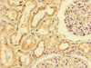 Immunohistochemistry of paraffin-embedded human kidney tissue using CSB-PA014875LA01HU at dilution of 1:100