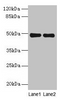 Western blot<br />
 All lanes: MRPS5 antibody at 5µg/ml<br />
 Lane 1: Hela whole cell lysate<br />
 Lane 2: Jurkat whole cell lysate<br />
 Secondary<br />
 Goat polyclonal to rabbit IgG at 1/10000 dilution<br />
 Predicted band size: 49, 28 kDa<br />
 Observed band size: 49 kDa<br />