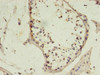 Immunohistochemistry of paraffin-embedded human testis tissue using CSB-PA015032HA01HU at dilution of 1:100