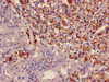 Immunohistochemistry of paraffin-embedded human adrenal gland tissue using CSB-PA01524A0Rb at dilution of 1:100