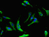 Immunofluorescent analysis of Hela cells using CSB-PA015890LA01HU at dilution of 1:100 and Alexa Fluor 488-congugated AffiniPure Goat Anti-Rabbit IgG (H+L)