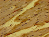 Immunohistochemistry of paraffin-embedded human skeletal muscle tissue using CSB-PA015891LA01HU at dilution of 1:100