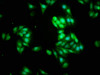 Immunofluorescence staining of HepG2 cells with CSB-PA015921HA01HU at 1:266, counter-stained with DAPI. The cells were fixed in 4% formaldehyde, permeabilized using 0.2% Triton X-100 and blocked in 10% normal Goat Serum. The cells were then incubated with the antibody overnight at 4°C. The secondary antibody was Alexa Fluor 488-congugated AffiniPure Goat Anti-Rabbit IgG (H+L) .