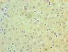 Immunohistochemistry of paraffin-embedded human liver tissue using CSB-PA01594A0Rb at dilution of 1:100