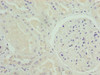 Immunohistochemistry of paraffin-embedded human kidney tissue using CSB-PA015961LA01HU at dilution of 1:100