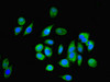 Immunofluorescent analysis of A549 cells using CSB-PA015976LA01HU at dilution of 1:100 and Alexa Fluor 488-congugated AffiniPure Goat Anti-Rabbit IgG (H+L)
