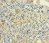 Immunohistochemistry of paraffin-embedded human adrenal gland tissue using CSB-PA016190LA01HU at dilution of 1:100