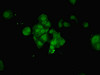 Immunofluorescent analysis of MCF-7 cells using CSB-PA016195LA01HU at dilution of 1:100 and Alexa Fluor 488-congugated AffiniPure Goat Anti-Rabbit IgG (H+L)