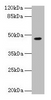 Western blot<br />
 All lanes: NXF5 antibody at 4µg/ml + HL60 whole cell lysate<br />
 Secondary<br />
 Goat polyclonal to rabbit IgG at 1/10000 dilution<br />
 Predicted band size: 46, 43, 20, 36, 35 kDa<br />
 Observed band size: 46 kDa<br />