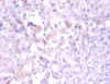 Immunohistochemistry of paraffin-embedded human liver tissue using CSB-PA01665A0Rb at dilution of 1:100