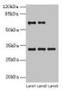 Western blot<br />
 All lanes: OTX2 antibody at 4µg/ml<br />
 Lane 1: Jurkat whole cell lysate<br />
 Lane 2: Hela whole cell lysate<br />
 Lane 3: Mouse lung tissue<br />
 Secondary<br />
 Goat polyclonal to rabbit IgG at 1/10000 dilution<br />
 Predicted band size: 32, 33 kDa<br />
 Observed band size: 32 kDa<br />