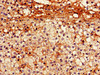 IHC image of CSB-PA017451LA01HU diluted at 1:600 and staining in paraffin-embedded human adrenal gland tissue performed on a Leica BondTM system. After dewaxing and hydration, antigen retrieval was mediated by high pressure in a citrate buffer (pH 6.0) . Section was blocked with 10% normal goat serum 30min at RT. Then primary antibody (1% BSA) was incubated at 4°C overnight. The primary is detected by a biotinylated secondary antibody and visualized using an HRP conjugated SP system.