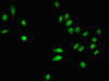 Immunofluorescent analysis of Hela cells using CSB-PA017456LA01HU at dilution of 1:100 and Alexa Fluor 488-congugated AffiniPure Goat Anti-Rabbit IgG (H+L)