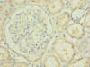 Immunohistochemistry of paraffin-embedded human kidney tissue using CSB-PA017501LA01HU at dilution of 1:100