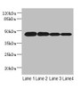 Western blot<br />
 All lanes: PCOLCE2 antibody at 8µg/ml<br />
 Lane 1: MCF-7 whole cell lysate<br />
 Lane 2: A549 whole cell lysate<br />
 Lane 3: HCT116 whole cell lysate<br />
 Lane 4: Human high value serum<br />
 Secondary<br />
 Goat polyclonal to rabbit IgG at 1/10000 dilution<br />
 Predicted band size: 46 kDa<br />
 Observed band size: 46 kDa<br />