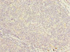 Immunohistochemistry of paraffin-embedded human tonsil tissue using CSB-PA017632LA01HU at dilution of 1:100 Immunohistochemistry of paraffin-embedded human tonsil tissue using CSB-PA017632LA01HU at dilution of 1:100