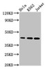 Western Blot<br />
 Positive WB detected in: Hela whole cell lysate, K562 whole cell lysate, Jurkat whole cell lysate<br />
 All lanes: PHF6 antibody at 2.8µg/ml<br />
 Secondary<br />
 Goat polyclonal to rabbit IgG at 1/50000 dilution<br />
 Predicted band size: 42, 36, 38 kDa<br />
 Observed band size: 42 kDa<br />