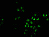 Immunofluorescence staining of Hela cells with CSB-PA017917LA01HU at 1:233, counter-stained with DAPI. The cells were fixed in 4% formaldehyde, permeabilized using 0.2% Triton X-100 and blocked in 10% normal Goat Serum. The cells were then incubated with the antibody overnight at 4°C. The secondary antibody was Alexa Fluor 488-congugated AffiniPure Goat Anti-Rabbit IgG (H+L) .