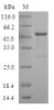 (Tris-Glycine gel) Discontinuous SDS-PAGE (reduced) with 5% enrichment gel and 15% separation gel.