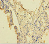 Immunohistochemistry of paraffin-embedded human lung tissue using CSB-PA018373LA01HU at dilution of 1:100
