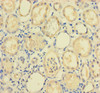Immunohistochemistry of paraffin-embedded human kidney tissue using CSB-PA018373LA01HU at dilution of 1:100