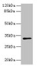 Western blot<br />
 All lanes: PLPP2 antibody at 8µg/ml + MCF-7 whole cell lysate<br />
 Secondary<br />
 Goat polyclonal to rabbit IgG at 1/10000 dilution<br />
 Predicted band size: 33, 35, 27 kDa<br />
 Observed band size: 33 kDa<br />