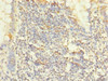 Immunohistochemistry of paraffin-embedded human small intestine tissue using CSB-PA018416LA01HU at dilution of 1:100