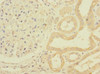 Immunohistochemistry of paraffin-embedded human kidney tissue using CSB-PA018453LA01HU at dilution of 1:100