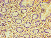 Immunohistochemistry of paraffin-embedded human small intestine tissue using CSB-PA018603LA01HU at dilution of 1:100