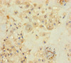 Immunohistochemistry of paraffin-embedded human placenta tissue using CSB-PA018719LA01HU at dilution of 1:100
