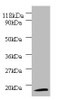 Western blot<br />
 All lanes: 40S ribosomal protein S11 antibody at 2µg/ml + 293T whole cell lysate<br />
 Secondary<br />
 Goat polyclonal to rabbit IgG at 1/10000 dilution<br />
 Predicted band size: 18 kDa<br />
 Observed band size: 18 kDa<br />