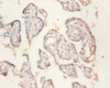 Immunohistochemistry of paraffin-embedded human placenta tissue using CSB-PA01874A0Rb at dilution of 1:100