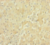 Immunohistochemistry of paraffin-embedded human liver tissue using CSB-PA018817LA01HU at dilution of 1:100