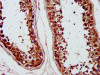 IHC image of CSB-PA018896LA01HU diluted at 1:1200 and staining in paraffin-embedded human testis tissue performed on a Leica BondTM system. After dewaxing and hydration, antigen retrieval was mediated by high pressure in a citrate buffer (pH 6.0) . Section was blocked with 10% normal goat serum 30min at RT. Then primary antibody (1% BSA) was incubated at 4°C overnight. The primary is detected by a biotinylated secondary antibody and visualized using an HRP conjugated SP system.