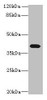 Western blot<br />
 All lanes: PTAFR antibody at 4µg/ml + Mouse lung tissue<br />
 Secondary<br />
 Goat polyclonal to rabbit IgG at 1/10000 dilution<br />
 Predicted band size: 40 kDa<br />
 Observed band size: 40 kDa<br />