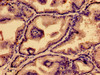 Immunohistochemistry of paraffin-embedded human prostate tissue using CSB-PA018969HA01HU at dilution of 1:100