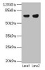 Western blot<br />
 All lanes: PTPN6 antibody at 12µg/ml<br />
 Lane 1: Jurkat whole cell lysate<br />
 Lane 2: Raji whole cell lysate<br />
 Secondary<br />
 Goat polyclonal to rabbit IgG at 1/10000 dilution<br />
 Predicted band size: 68, 64, 71 kDa<br />
 Observed band size: 68 kDa<br />