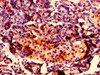 Immunohistochemistry of paraffin-embedded human pancreatic tissue using CSB-PA019152LA01HU at dilution of 1:100